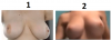 breastc.png