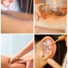 Fire Cupping or Acupressure Massage at your home!