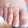 Mobile Diabetic Foot Care Available