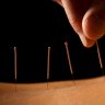 Acupuncture & Massage for immediate Pain relief