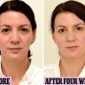 Anti Aging Facial / Brightening Facial/ Hydration Facial
