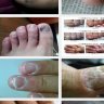 Feet care