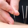 Acupuncture and Massage Clinic in Mission