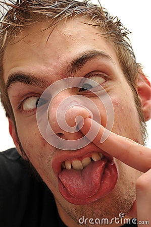 ridiculous-man-picking-his-nose-with-crossed-eyes-thumb11673964.jpg